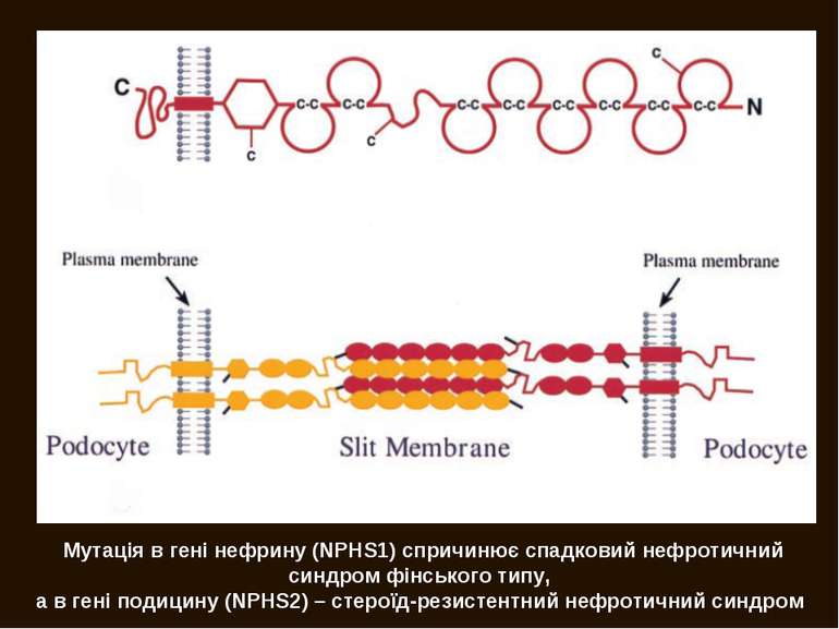 Мутація в гені нефрину (NPHS1) спричинює спадковий нефротичний синдром фінськ...