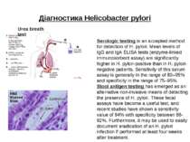 Діагностика Helicobacter pylori Urea breath test Serologic testing is an acce...