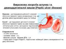 Виразкова хвороба шлунка та дванадцятипалої кишки (Peptic ulcer disease) Вира...