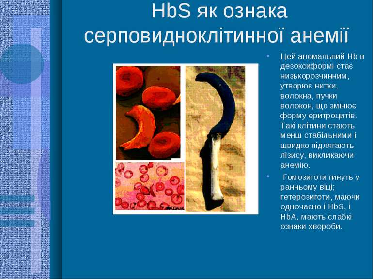 HbS як ознака серповидноклітинної анемії Цей аномальний Hb в дезоксиформі ста...