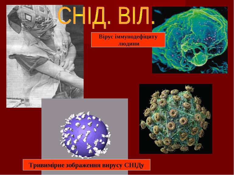Тривимірне зображення вирусу СНІДу Вірус іммунодефіциту людини