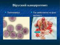 Вірусний канцерогенез Папіломавірус Рак шийки матки на фоні вагітності