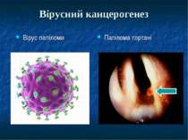 Вірусний канцерогенез Вірус папіломи Папілома гортані