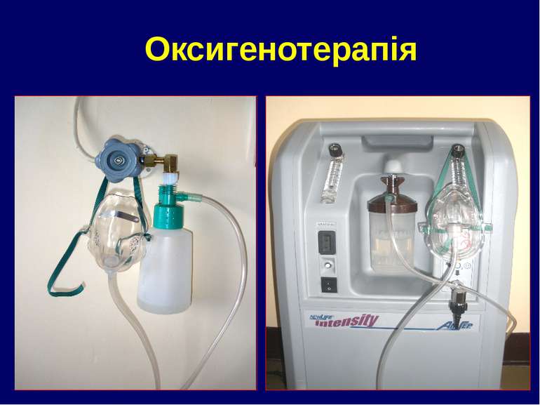 Оксигенотерапія