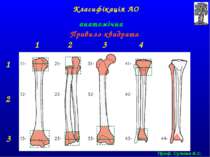 Класифікація АО анатомічна Правило квадрата 1 2 3 1 2 3 4 Проф. Сулима В.С.