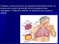 Пневмонія - запалення легенів. Це інфекційне захворювання легень, що виникає ...