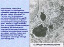 В цитоплазмі гепатоцитів спостарігається накопичення обмежених мембраною елек...