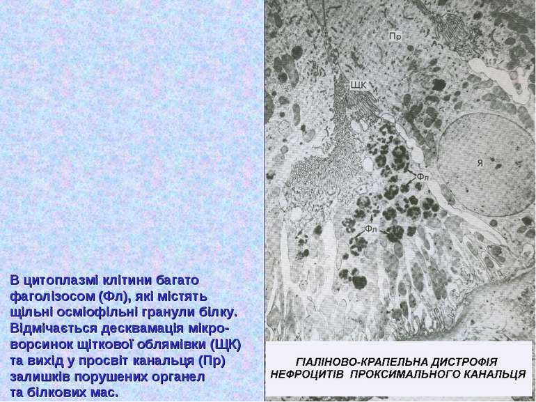 В цитоплазмі клітини багато фаголізосом (Фл), які містять щільні осміофільні ...