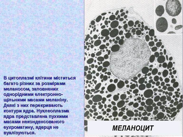 В цитоплазмі клітини міститься багато різних за розмірами меланосом, заповнен...