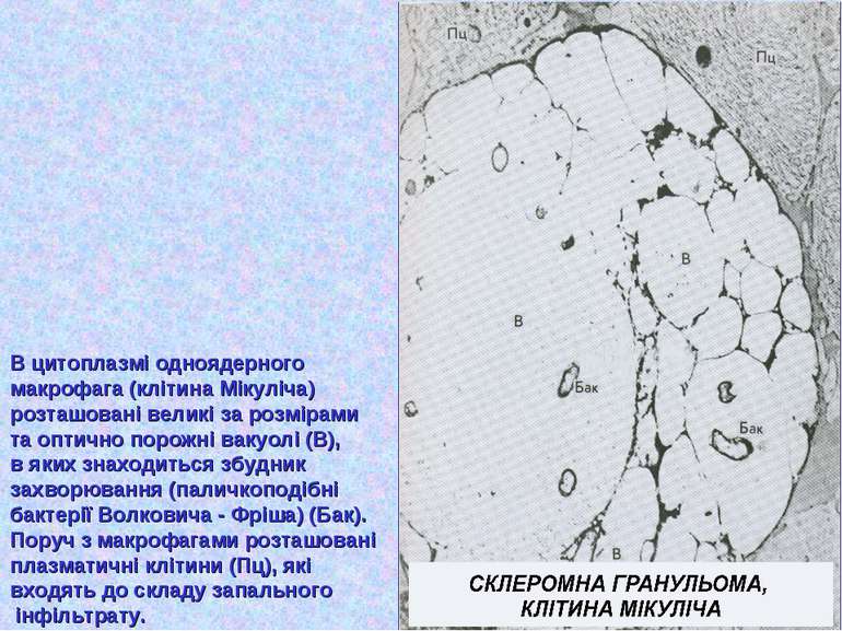 В цитоплазмі одноядерного макрофага (клітина Мікуліча) розташовані великі за ...