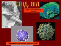 Тривимірне зображення вирусу СНІДу Вірус іммунодефіциту людини