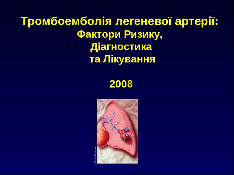 Тромбоемболія легеневої артерії: Фактори Ризику, Діагностика та Лікування 2008