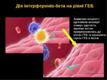 Зниження кількості адгезивніх молекул знижує здатність імунних клітин прикріп...