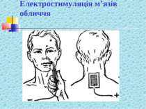Електростимуляція м’язів обличчя