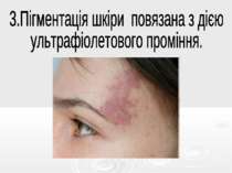 3.Пігментація шкіри повязана з дією ультрафіолетового проміння.