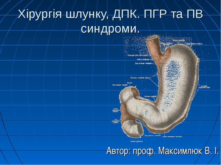 Хірургія шлунку, ДПК. ПГР та ПВ синдроми. Автор: проф. Максимлюк В. І.