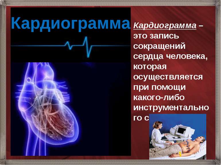 Кардиограмма Кардиограмма – это запись сокращений сердца человека, которая ос...