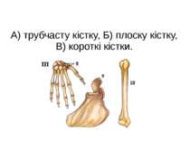 А) трубчасту кістку, Б) плоску кістку, В) короткі кістки.