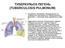 ТУБЕРКУЛЬОЗ ЛЕГЕНЬ (TUBERCULOSIS PULMONUM) Етіологія і патогенез. Захворюванн...