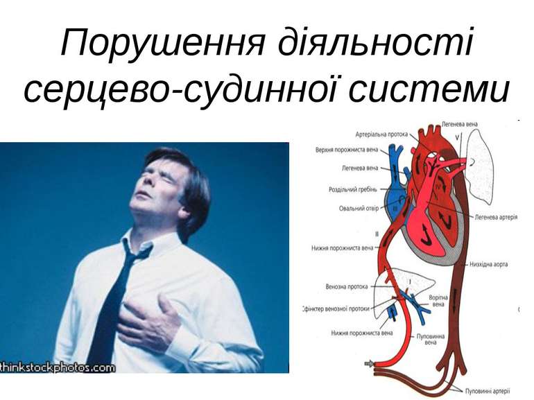 Порушення діяльності серцево-судинної системи