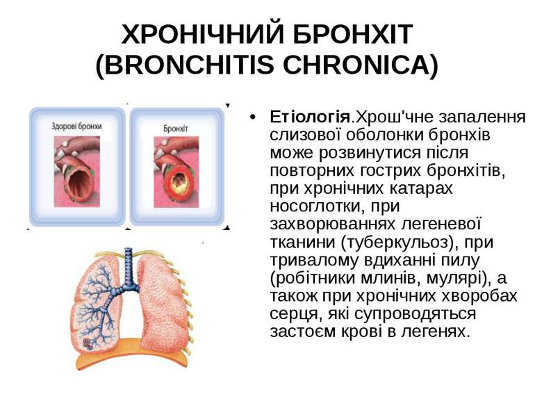 ХРОНІЧНИЙ БРОНХІТ (BRONCHITIS CHRONICA) Етіологія.Хрош'чне запалення слизової...