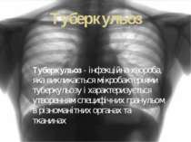 Туберкульоз Туберкульоз - інфекційна хвороба, яка викликається мікробактеріям...
