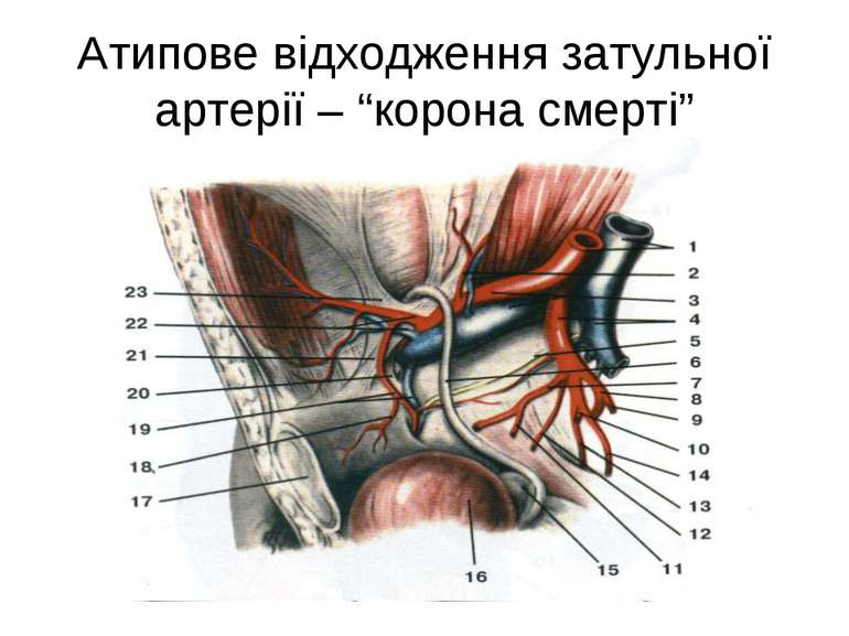 Атипове відходження затульної артерії – “корона смерті”