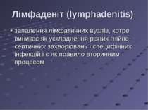 Лімфаденіт (lymphadenitis) запалення лімфатичних вузлів, котре виникає як уск...