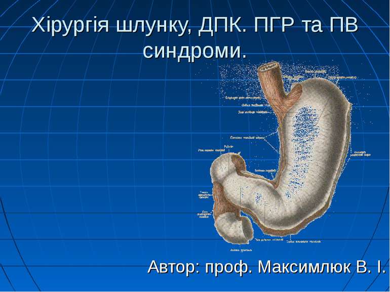 Хірургія шлунку, ДПК. ПГР та ПВ синдроми. Автор: проф. Максимлюк В. І.