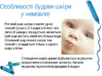 Особливості будови шкіри у немовлят Роговий шар шкіри в малят дуже тонкий (ус...