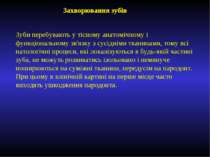 Захворювання зубів Зуби перебувають у тісному анатомічному і функціональному ...