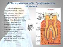 4. Захворювання зубів. Профілактика та лікування. Найпоширенішою хворобою зуб...