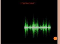 УЛЬТРАЗВУК — пружні звукові коливання високої частоти від 20 000 до 1000000 Гц