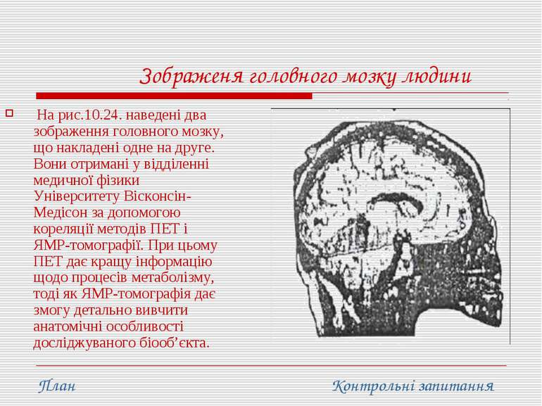 Зображеня головного мозку людини На рис.10.24. наведені два зображення головн...