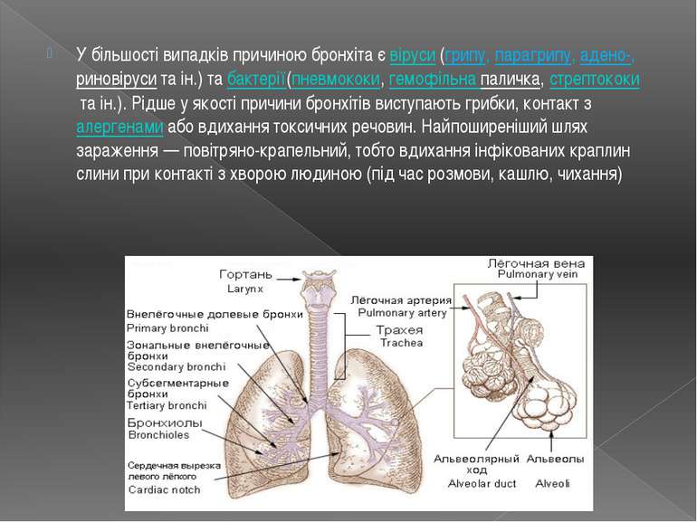 У більшості випадків причиною бронхіта є віруси (грипу, парагрипу, адено-, ри...