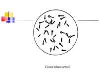 Clostridium tetani