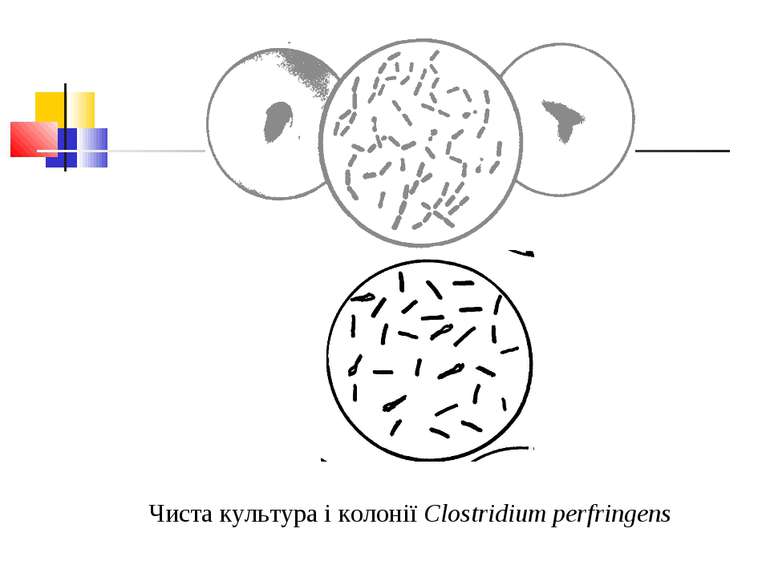 Чиста культура і колонії Clostridium perfringens