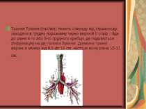Трахея Трахея (trachea) лежить спереду від стравоходу, заходячи в грудну поро...