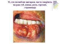 Ті, хто полюбляє цигарки, часто хворіють на рак губ, язика, рота, гортані, ст...