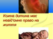 Кожна дитина має невід’ємне право на життя Кириченко В.А