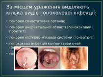 За місцем ураження виділяють кілька видів гонококової інфекції: гонорея сечос...