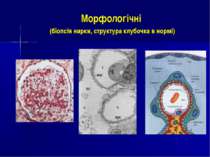 Морфологічні (біопсія нирки, структура клубочка в нормі)