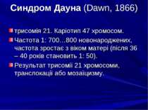 Синдром Дауна (Dawn, 1866) трисомія 21. Каріотип 47 хромосом. Частота 1: 700…...