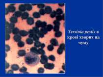Yersinia pestis в крові хворих на чуму