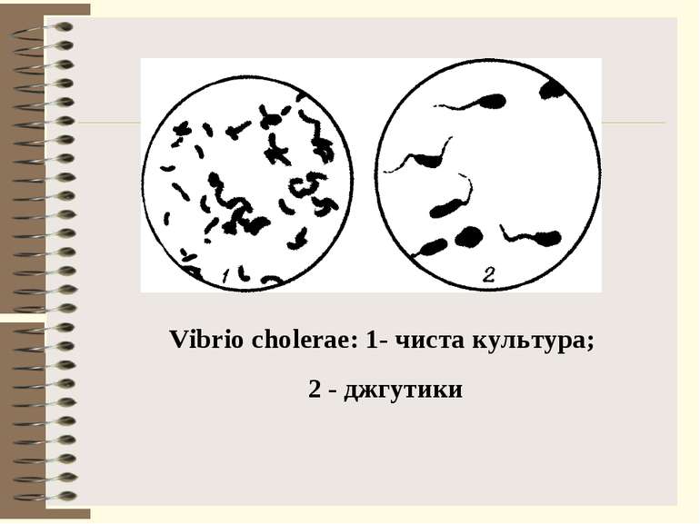 Vibrio cholerae: 1- чиста культура; 2 - джгутики