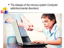 The disease of the nervous system Computer addiction(mental disorders)