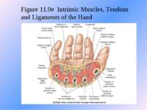 Figure 11.9e Intrinsic Muscles, Tendons and Ligaments of the Hand