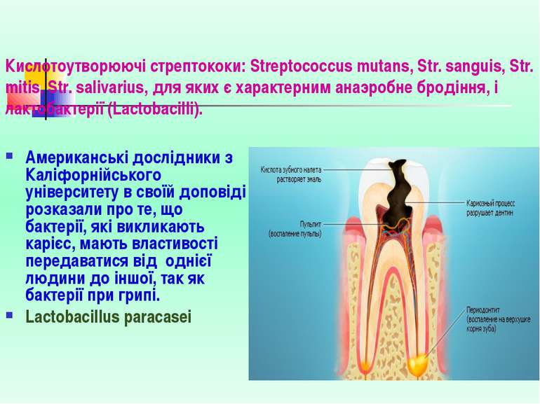 Кислотоутворюючі стрептококи: Streptococcus mutans, Str. sanguis, Str. mitis,...