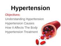 Hypertension Objectives: Understanding Hypertension Hypertension Causes How I...