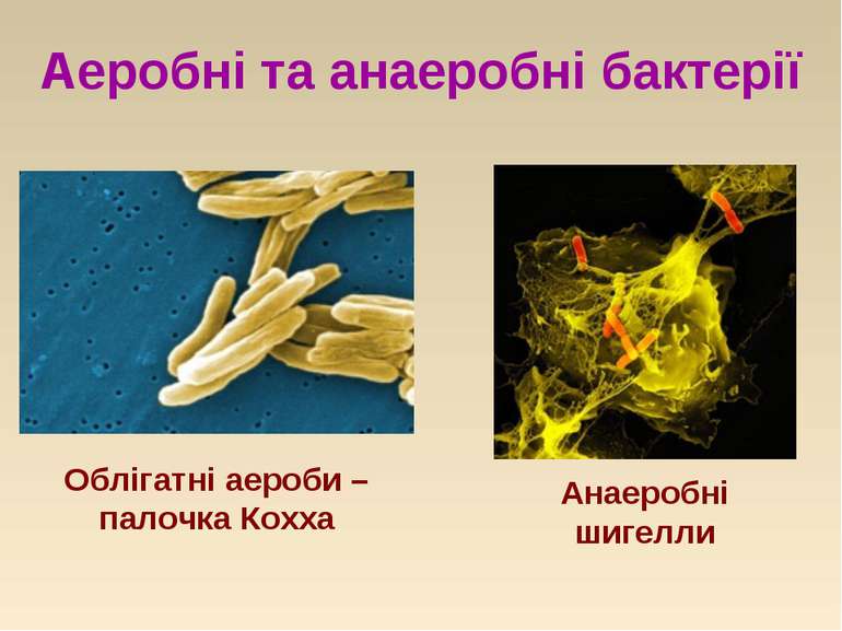 Аеробні та анаеробні бактерії Анаеробні шигелли Облігатні аероби –палочка Кохха